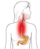 acidezestomacal.jpg